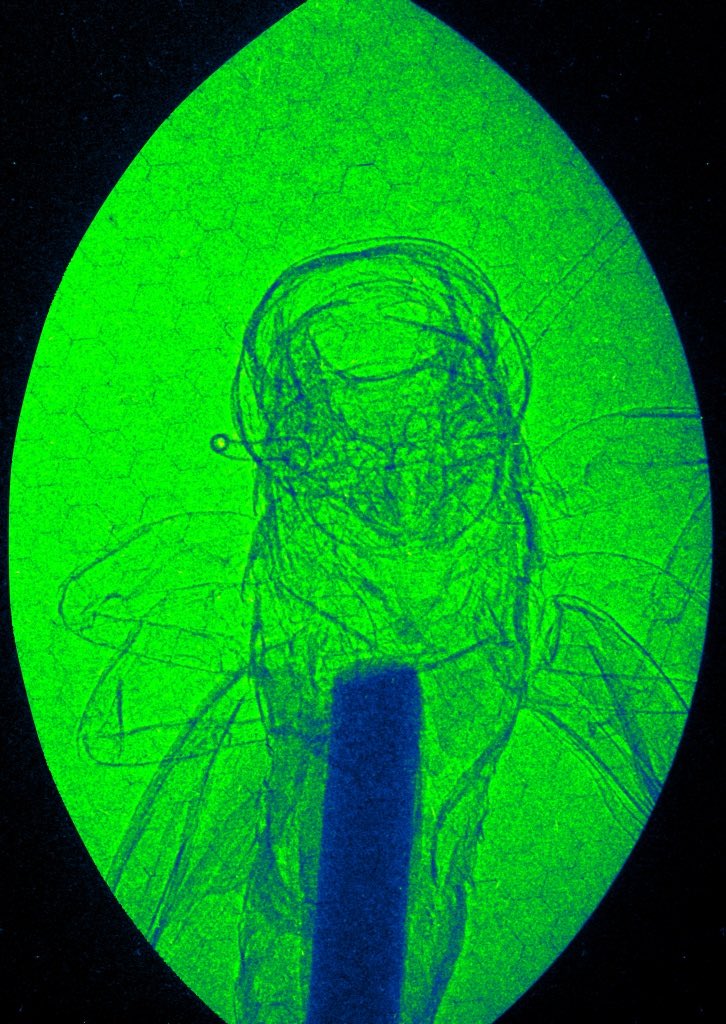 X-ray Phase Contrast Imaging